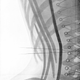 Illustration for article titled X-ray images of women in corsets show skeletons in a bind